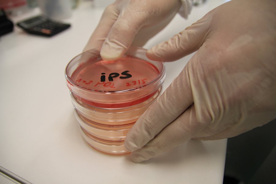 Piastre di coltura con cellule iPS etichettate in laboratorio