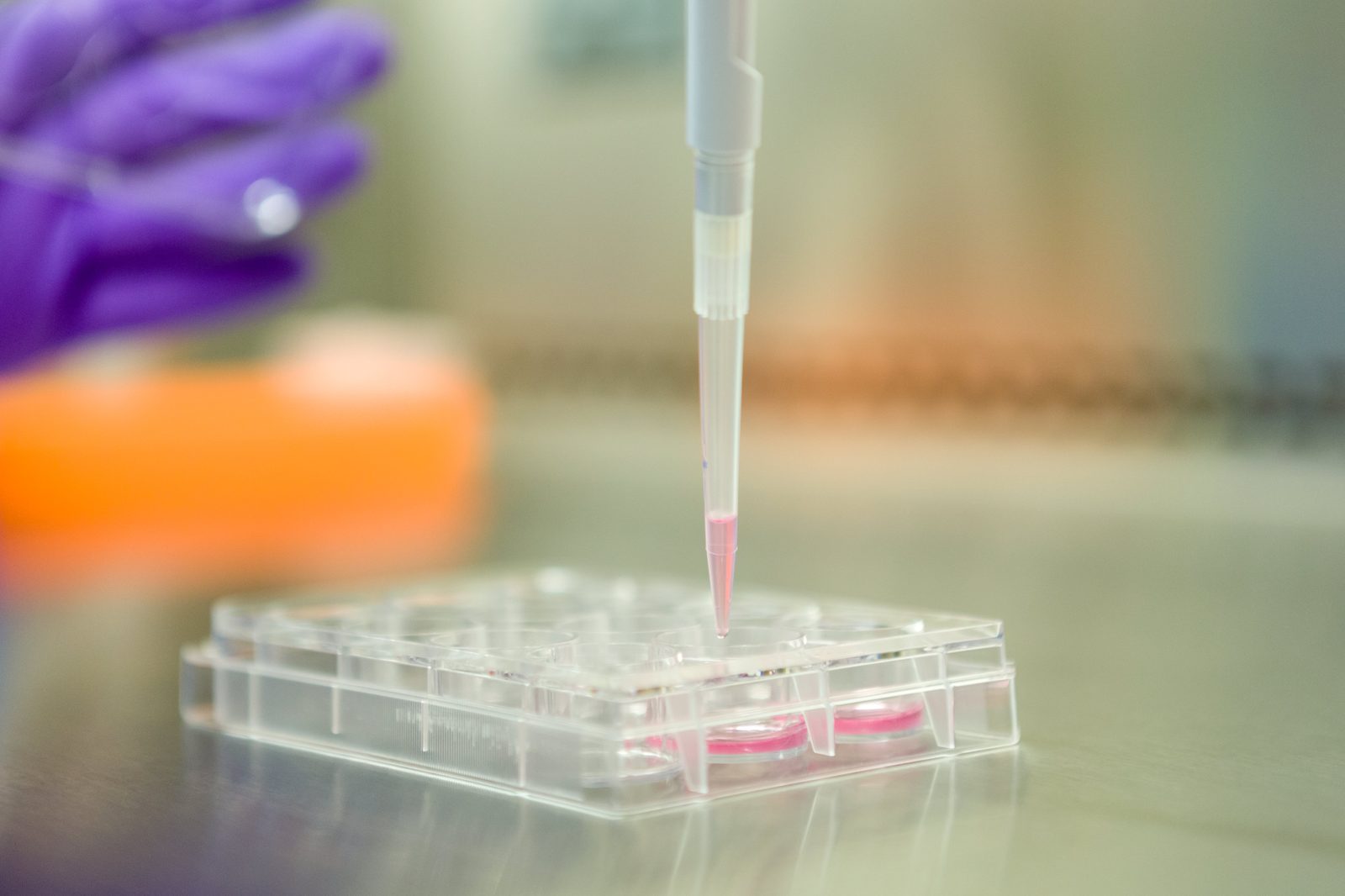 Ricercatore in guanti pipetta un campione rosa in una piastra multipozzetto durante una coltura cellulare in laboratorio